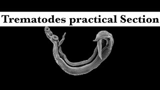 Parasitology practical part 1 Trematodes section [upl. by Drogin503]