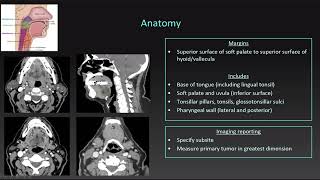 02 TNM Staging Oropharynx [upl. by Idoj]