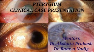 PTERYGIUM [upl. by Anev]