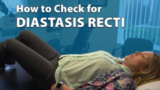 How to Check for Diastasis Recti [upl. by Aerdnod]