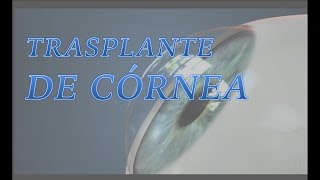 TRASPLANTE DE CÓRNEA [upl. by Blader]