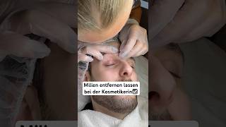 Milien entfernen☑️ hautpflege skincare gesichtsbehandlung kosmetiker ausreinigen [upl. by Dobson]