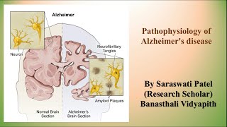 Pathophysiology of Alzheimer disease [upl. by Mazman581]