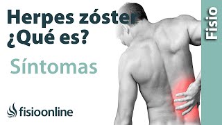 HERPES ZÓSTER  Qué es qué estructuras afecta síntomas signos causas y tratamiento [upl. by Nnaecarg59]