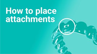 How to Place Attachments in Aligners Avoid These Common Mistakes [upl. by Eceer455]