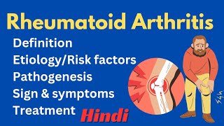 Rheumatoid Arthritis  Definition  Causes  Pathogenesis  Sign amp Symptoms  गठिया Treatment [upl. by Nahtonoj]