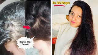 CASTOR HAIR GROWTH CHALLENGE  Use Castor Oil like this for 30 Days  Double Hair Growth amp Density [upl. by Putnem]