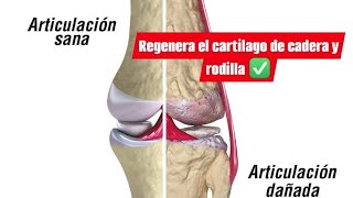 REGENERA EL CARTILAGO DE CADERA Y RODILLA 💥 [upl. by Shishko]