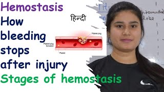 Hemostasis  Stages  Vasospasm  Clot Retraction amp Repair  Clotting of Blood  Breakdown of Clot [upl. by Georgy551]