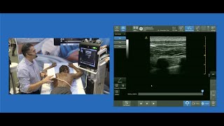 Paramedian Sagittal Approach to Thoracic Paravertebral Block [upl. by Nuahsor]