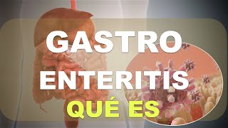 ¿Qué es la Gastroenteritis Explicación [upl. by Fernande275]