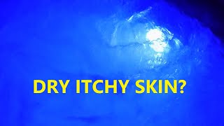 Why Do Hot Tubs Make You Itchy [upl. by Tekcirk]