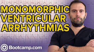 Monomorphic Ventricular Tachycardia  HIGHYIELD CARDIOLOGY  USMLE STEP 1 [upl. by Swehttam]