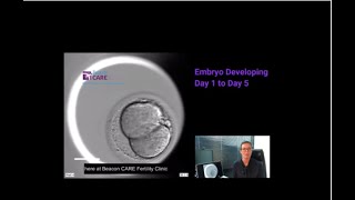 Embryo Developing from Day 1 to Day 5 explained by Sharon Corcoran from Beacon CARE Fertility [upl. by Abey]