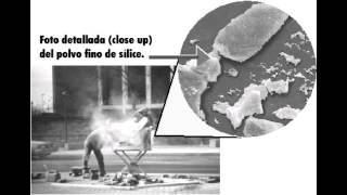 Pneumoconioses  Anthracosis Silicosis amp Asbestosis [upl. by Marlie251]