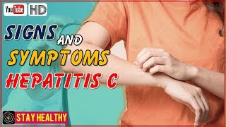 10 Signs and Symptoms of Hepatitis C [upl. by Ecissej]