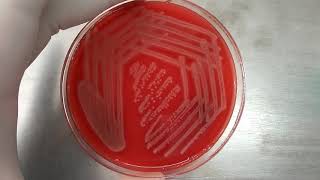 Staphylococcus aureus on blood agar with beta hemolytic colony [upl. by Ettennahs]