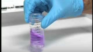 Chloride Test [upl. by Eibba]