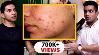 Heal Adult Acne Forever  Accutane Cortisol amp Diet Guidelines By Luke Coutinho [upl. by Tricia]