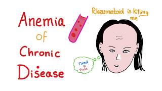 Anemia of Chronic Disease  Anemia of Inflammation All you need to know  Hematology Series [upl. by Azeel]