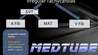 ECGs abnormal rhythms Irregular Tachycardias [upl. by Eiramesor]