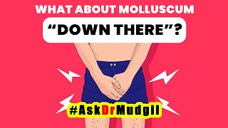 WHAT ABOUT MOLLUSCUM “DOWN THERE” [upl. by Beckett]