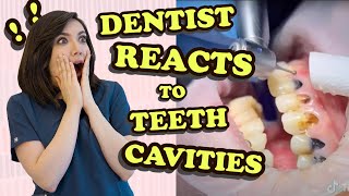 Dentist Reacts to Teeth Cavity Videos [upl. by Amaral455]