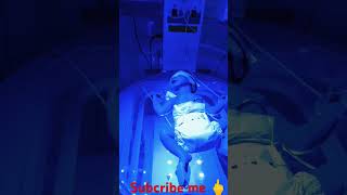 PHOTOTHERAPY IS A TREATMENT NEWBORN BABY niculife hospital baby viralbaby [upl. by Giles]