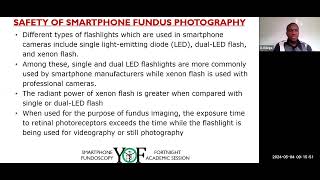 Smartphone Fundoscopy II [upl. by Ane498]