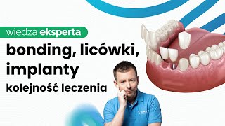 BONDING I LICÓWKI A LECZENIE IMPLANTOLOGICZNE [upl. by Omik]