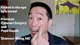 Kicked in the eye by a horse Pupil repair and premium cataract surgery Shannon Wong MD [upl. by Ailat]