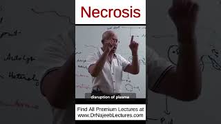 Necrosis drnajeeb drnajeeblectures shortvideo youtubeshorts [upl. by Haelahk]