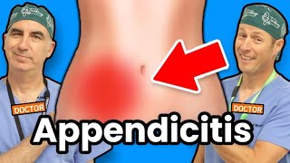 Appendicitis  How Do I Know If I Have Appendicitis [upl. by Tanberg]