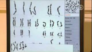 FWU  Chromosomen des Menschen  Erbkrankheiten und Karyogramme [upl. by Primo]