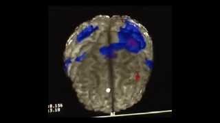 Kinesio effect on cortical brain activity fMRI [upl. by Lewis]