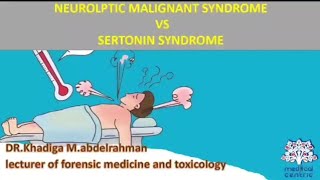 Neuroleptic malignant syndrome vs Sertonin syndrome Hyperthermia [upl. by Ayekahs]