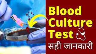 Blood Culture Test Procedure in Hindi  Blood Culture Test कैसे होता हैं [upl. by Mullac469]