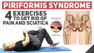 Piriformis Syndrome  Home Stretches amp Exercises [upl. by Kristan]