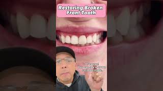 How to Fix Front Tooth if the Tooth Broke in Half Dental Crown  View Mobile Dental shorts [upl. by Yacov286]