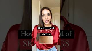 How to get rid of skin tags with pcos [upl. by Yun]