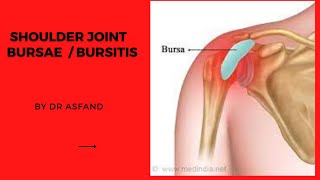 Shoulder Joint bursae Types  bursitis Treatment [upl. by Vladi]