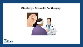 Otoplasty  Cosmetic Ear Surgery [upl. by Ahsilra]