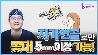 부작용 없는 자가연골로 콧대 높게 올리는 법 바로코에는 있다 [upl. by Ibmab]