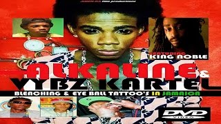 ALKALINE amp VYBZ KARTEL BLEACHING amp EYE BALL TATTOOS IN JAMAICA DVD feat King Noble HQ [upl. by Amehsyt531]