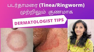 படர்தாமரை நிரந்தரமாக குணமாகHow to get rid of ringwormtineaDermatologist tipsTamil [upl. by Skricki209]