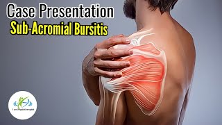 Shoulder bursitis  Subacromial bursa  Shoulder impingement exercises  Physical therapy case study [upl. by Nylarad]