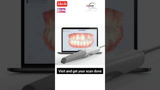 3D Intra Oral Scanning of your Teeth cadcam digital smilemakeover [upl. by Ahsikal]