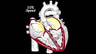 Unifocal Atrial Tachycardia animation shorts medical cardiology [upl. by Noble]