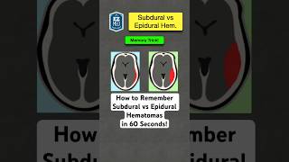 🔥 How to Remember Subdural vs Epidural Hematomas in 60 Seconds Nursing [upl. by Ennovy]