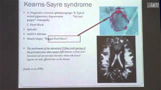 25 MRI Based Approach to Neurometabolic Disorders by Hamza Alsayouf SD [upl. by Palocz381]